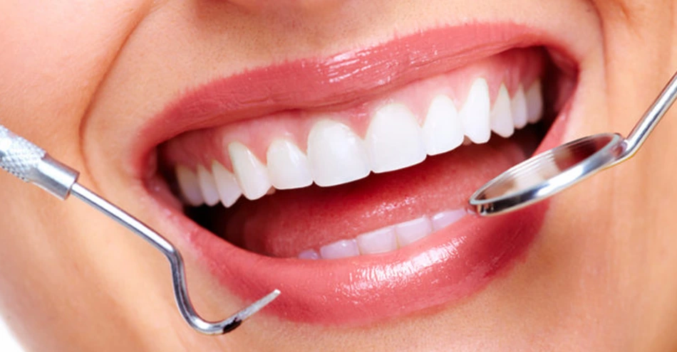 Smile makeover Lahore at Dental Professionals, Gulberg Lahore